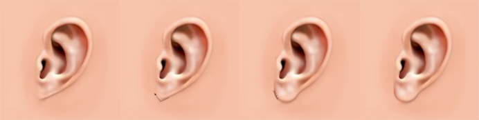 칼귀 Pixie ear